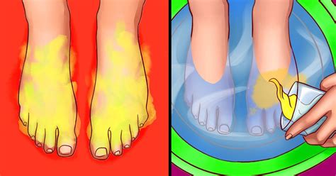 How To Get Rid Of Smelly Feet 5 Minute Crafts