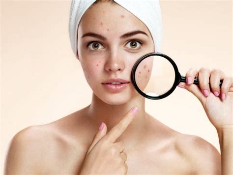Evaluating A Very Common Skin Condition Everything You Have To Know
