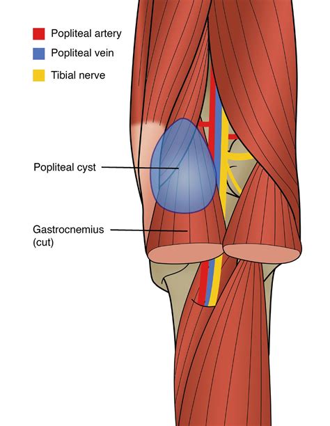 Sports Injury Bulletin Diagnose And Treat Lower Leg Pain In Athletes