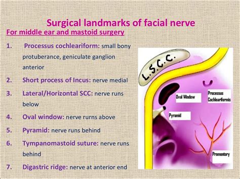 Clinical Anatomy Of Facial Nerve And Facial Nerve Palsy