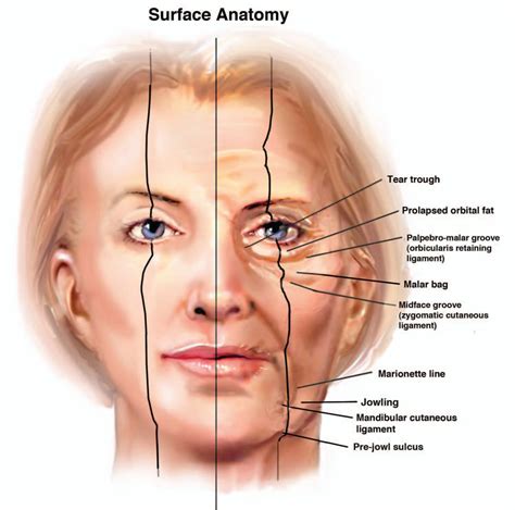 Aging Face Facial Aging Facial Aesthetics Facial Anatomy