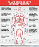 How Does Marijuana Affect The Body