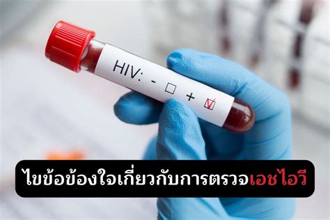 ไขข้อข้องใจเกี่ยวกับการตรวจเอชไอวี เอชไอวี Hiv