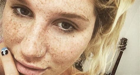 Kesha Shows Off Her Freckles In Gorgeous Selfie