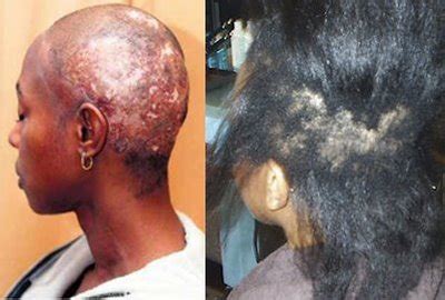 There are a wide range of relaxers available rusk relaxers do not completely straighten hair like chemical straightening treatments. 10 TIPS TO GROW BACK HEALTHY NATURAL HAIRLINE ...