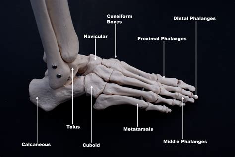 5th Metatarsal Fractures Newcastle Physiotherapy