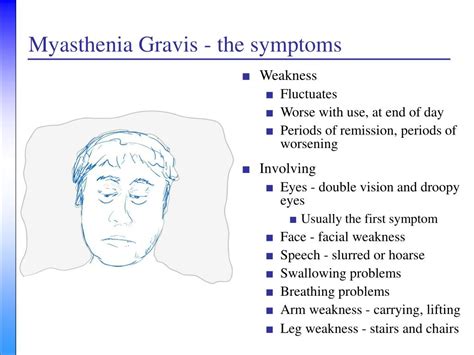 Juvenile myasthenia gravis (jmg) is a rare condition of childhood and has many clinical features that. PPT - Myasthenia Gravis: A Neurologist's Perspective ...