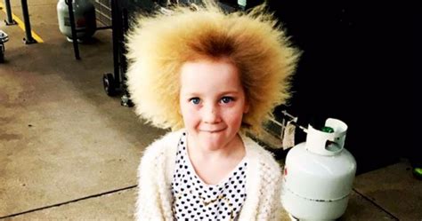 Little Girls Rare Condition Makes Every Day The Most Adorable Bad Hair