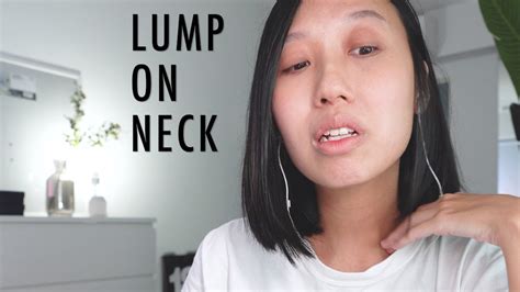 Lump On Neck Cancer Symptoms