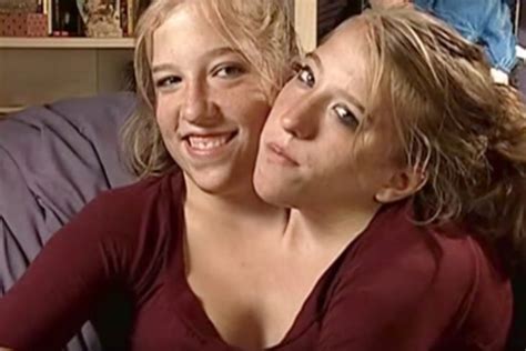 Abby And Brittany Hensel Conjoined Twins Where Are They Now Oddlasopa
