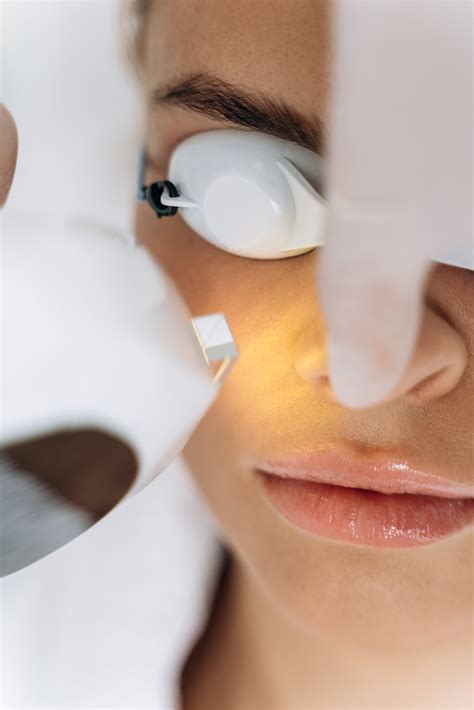 Lumecca Ipl And Photofacial In Myrtle Beach Anti Aging And Rosacea