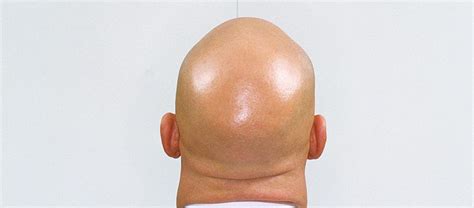 Bald Head Texture