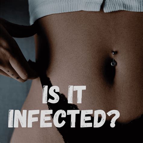 Signs And Treatment Of An Infected Belly Button Piercing 2022