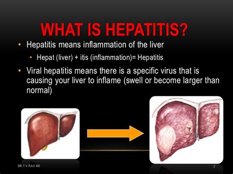 There are five types, but the most common ones in the u.s. Hepatitis A Infection
