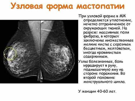 Мастопатия лечение и диета Как выглядит фиброзно кистозная мастопатия фото Как выглядит фиброзно кистозная мастопатия фото Мастопатия лечение и диета