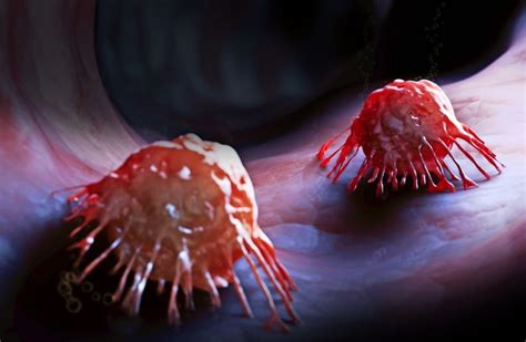 Alte blutflecken aus der matratze entfernen. Medizin: Die Blutspur des Tumors - Wissen - Stuttgarter ...