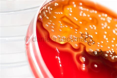 Staphylococcus Aureus On Schaedler Agar L I C H T T E I L C H E N