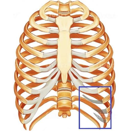 What Is Slipping Rib Syndrome