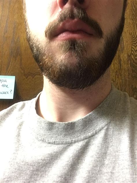 I 19m Have Had A Beard For A Couple Of Years And Looking To Improve Some Parts Are Thicker