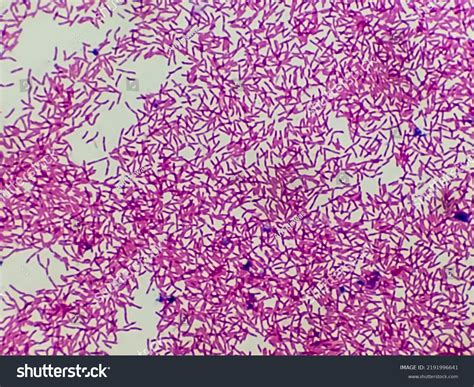 Microscopic View Gram Stain Showing Rod Stock Photo 2191996641