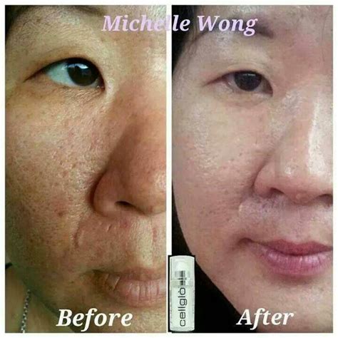 Creme 21 = 2 in 1 (beauty + wellness). EaHui の ブログ ♥: Improve your skin & body with Cellglo Creme 21