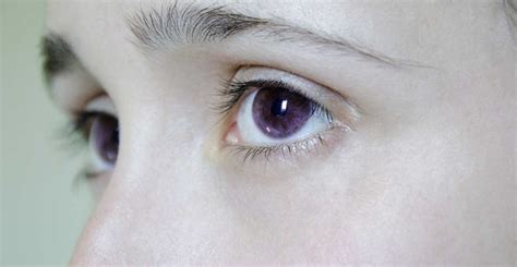 A Collection Of People With Purple Eyes And What Causes Them