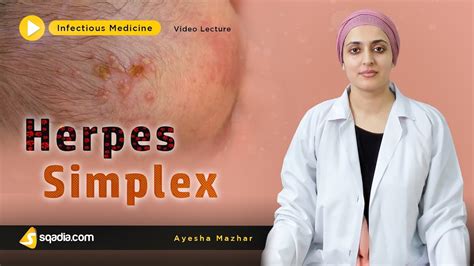 Herpes Simplex Infectious Diseases Medicine Lecture Medical V