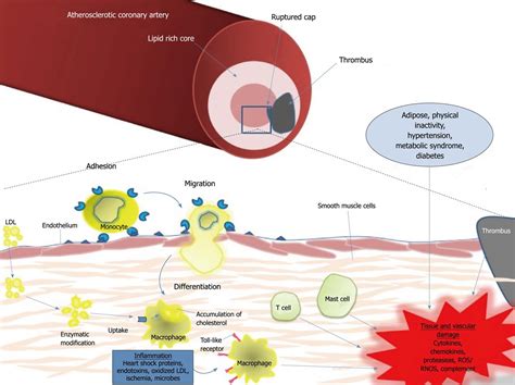 Ischemiareperfusion Injury The Role Of Immune Cells