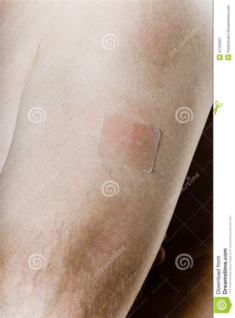 Man Arm With Nicotine Patch Stock Image Image Of Healthcare White
