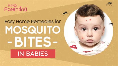 10 Easy Home Remedies For Mosquito Bites On Babies And Kids Youtube