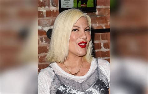 Tori Spelling Plastic Surgery Hell Injections Leave Her Face A Lumpy Mess