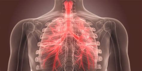 Bronquitis Es Contagioso Causas Síntomas Y Transmisión Naturalezax