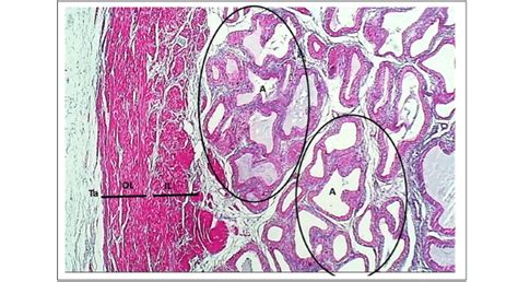 Section Of Vesicular Gland In Domestic Bull Shows Outer Muscularis