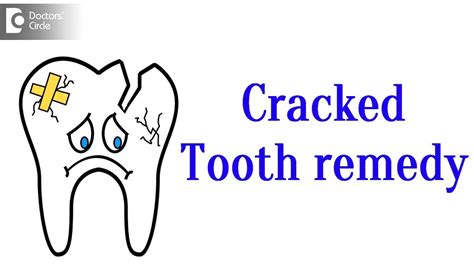 Cracked Tooth Treatment Youtube