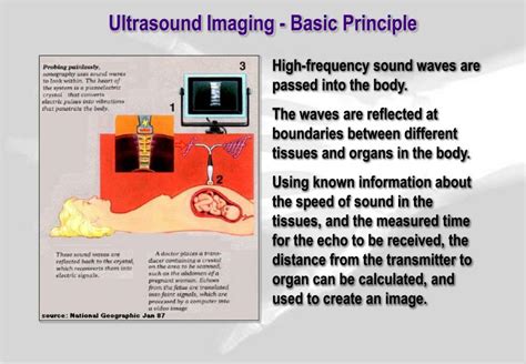 Reected sound waves through tissue. PPT - Medical Physics Ultrasound PowerPoint Presentation ...
