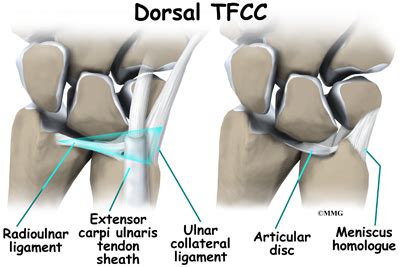 For more details such as their addresses, how to get there please. Triangular Fibrocartilage Complex (TFCC) Injuries ...