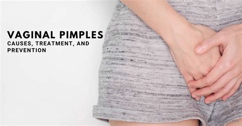 genital pimples causes symptoms treatment and prevention faqs