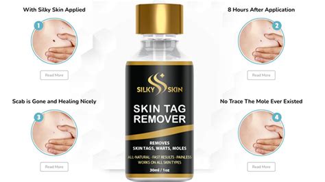 Silky Skin Tag Remover Reviews Beware Trust Mole And Skin Tag
