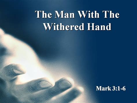 The Man With The Withered Hand 1 20 2013 Youtube