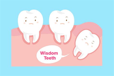 Tips For Wisdom Tooth Extraction Aftercare Luvic Advanced Dentistry