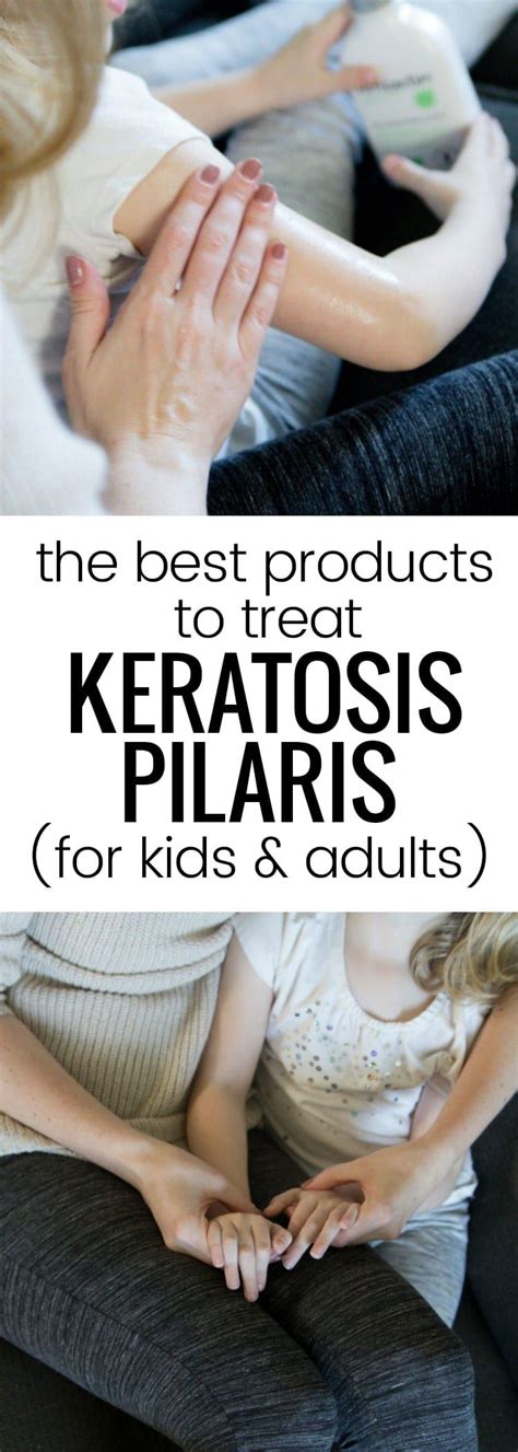 Amlactin Products Are Amazing For Treating Keratosis Pilaris In Adults