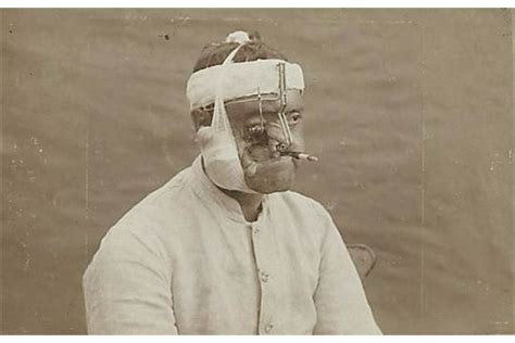 World War I Documentation Album Of Face Injuries Of German Soldiers