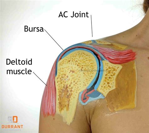 Shoulder tendonitis is an inflammation of one of the tendons in your shoulder. Shoulder Bursitis & Rotator Cuff Tears - Part Three