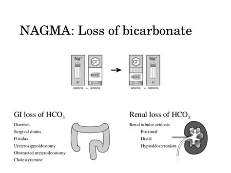 Non Anion Gap Metabolic Acidosis Nagma