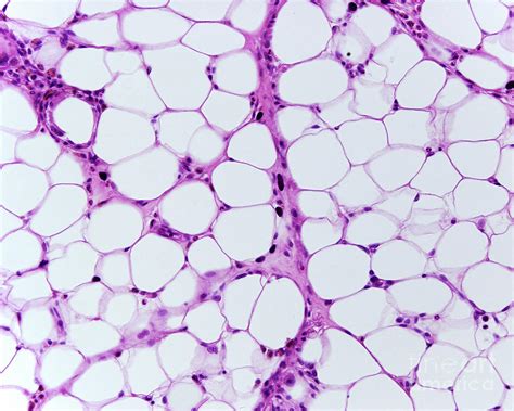 Adipose Tissue 1 By Jose Calvo Science Photo Library