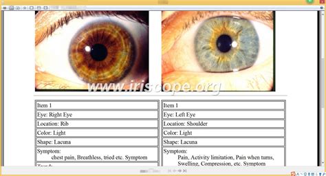 Iriscopio Obermax Iriscope Iridology Camera Iriscope Camera