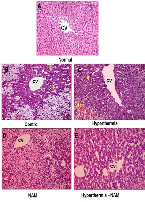 Representative Photos Of Liver Sections Of Mice 15 Days After Loading