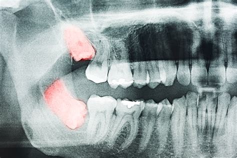 20 Signs Your Tooth Pain Is Signaling Something More Serious — Eat This