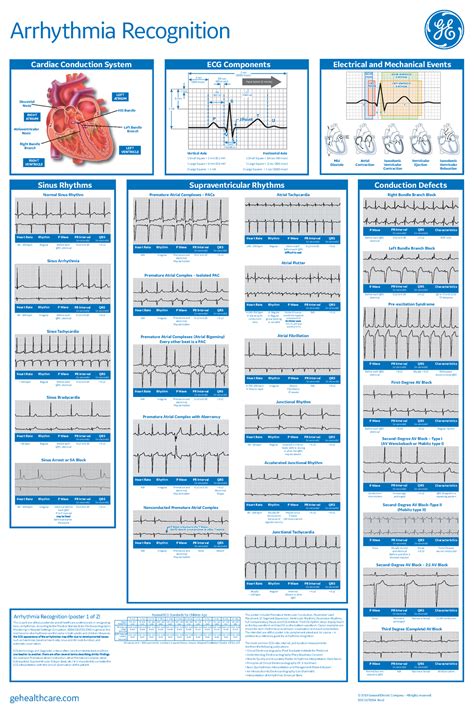 Arrhythmia Recognition Part 1 And 2 2019 Ge This Is Part One Of Two