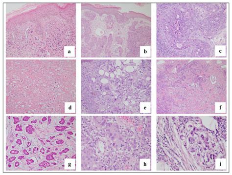 Dermatopathology Free Full Text Clinical And Histopathologic